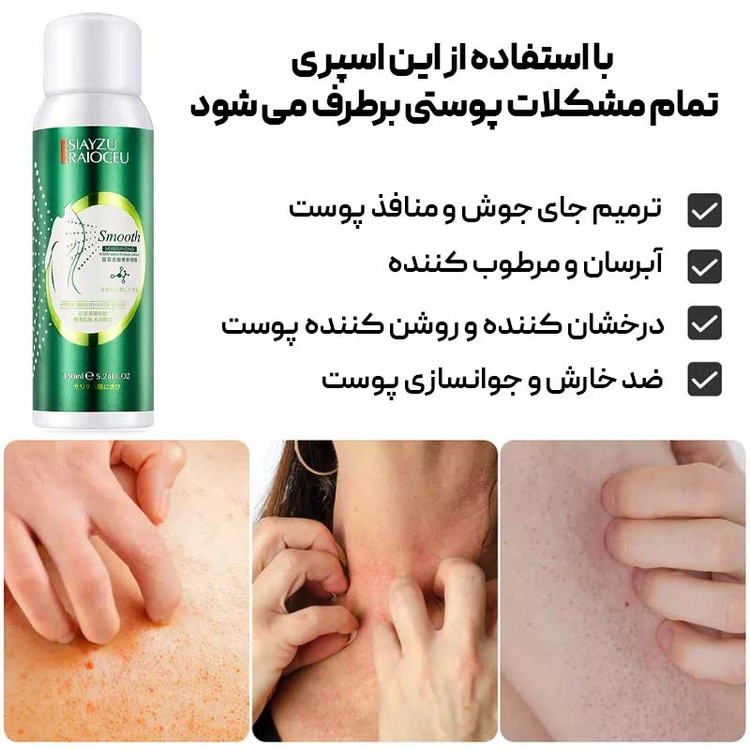 اسپری ضد جوش و درمان کننده جوش کل بدن📛